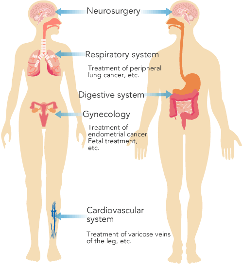 Examples of medical applications