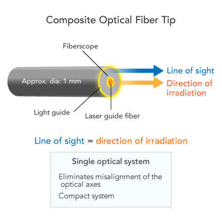 Medical applications｜OK Fiber Technology Co., Ltd. Composite-type ...