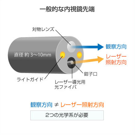 一般的な内視鏡